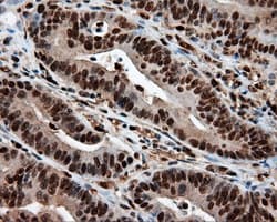 LTA4H / LTA4 Antibody (clone OTI7D11)