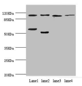 PITRM1 / MP1 Antibody