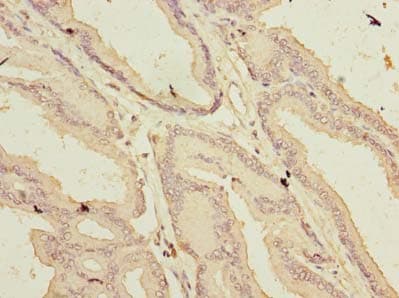 Polyclonal Rabbit anti-Human ARMCX1 Antibody (IHC)