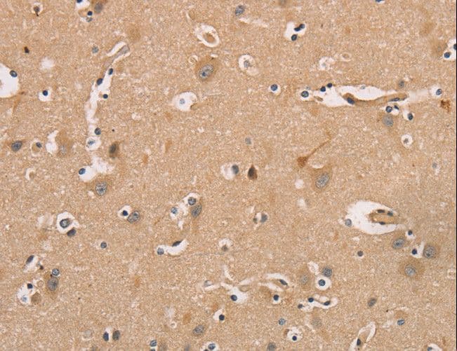 CDK11A + CDK11B Antibody
