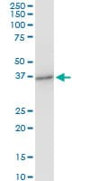 PRSS8 / Prostasin Antibody (clone 3C4)