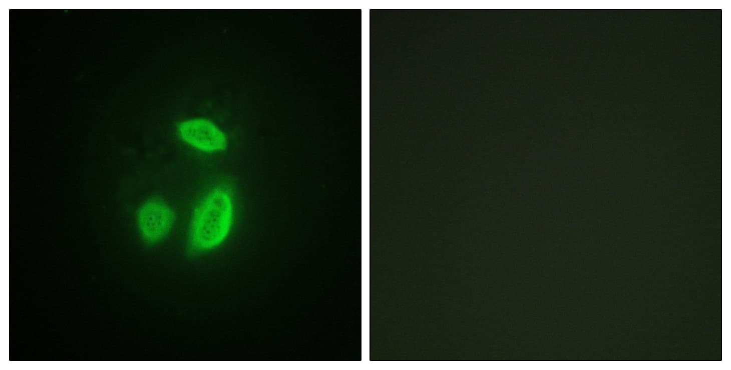 IHC-plus™ ESPL1 / Separase Antibody (aa767-816)