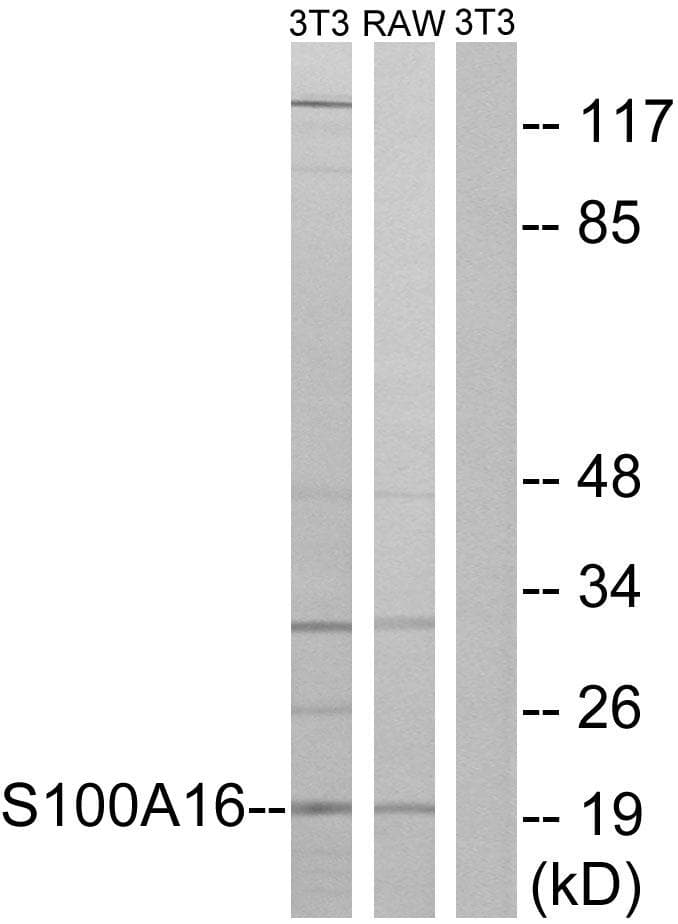 S100A16 Antibody