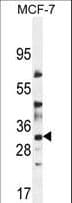 LYSMD4 Antibody (aa33-61)