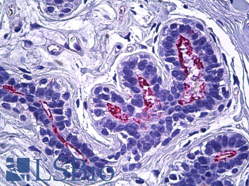 IHC-plus™ Ezrin + Radixin + Moesin Antibody (aa524-573)