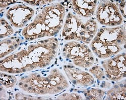 Monoclonal Mouse anti-Human BTK Antibody (clone OTI3D11, IHC, IF, WB)