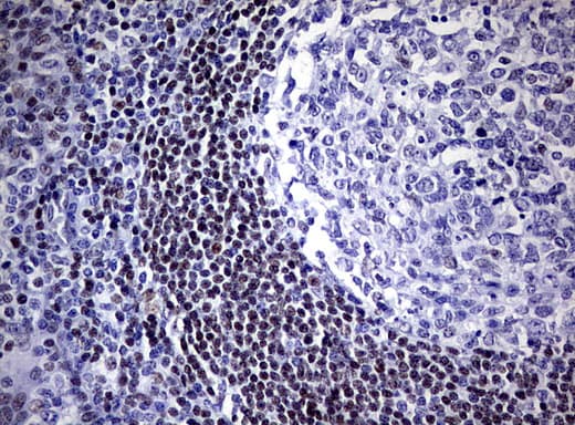 FOXP1 Antibody (clone UMAB89)