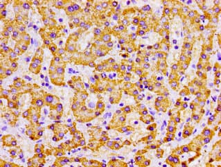 Polyclonal Rabbit anti-Human MPST Antibody (IHC, IF)