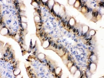 FABP1 / L-FABP Antibody