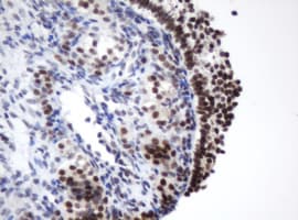 Monoclonal Mouse anti-Human METTL16 / METT10D Antibody (clone OTI3E8, IHC, WB)