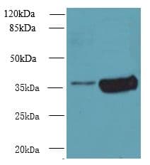 ARMC10 Antibody