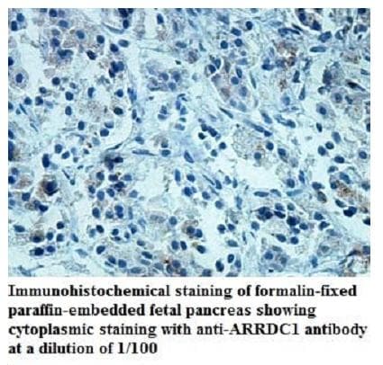 ARRDC1 Antibody (aa219-403)