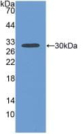 FBLN1 / Fibulin 1 Antibody (aa399-578)