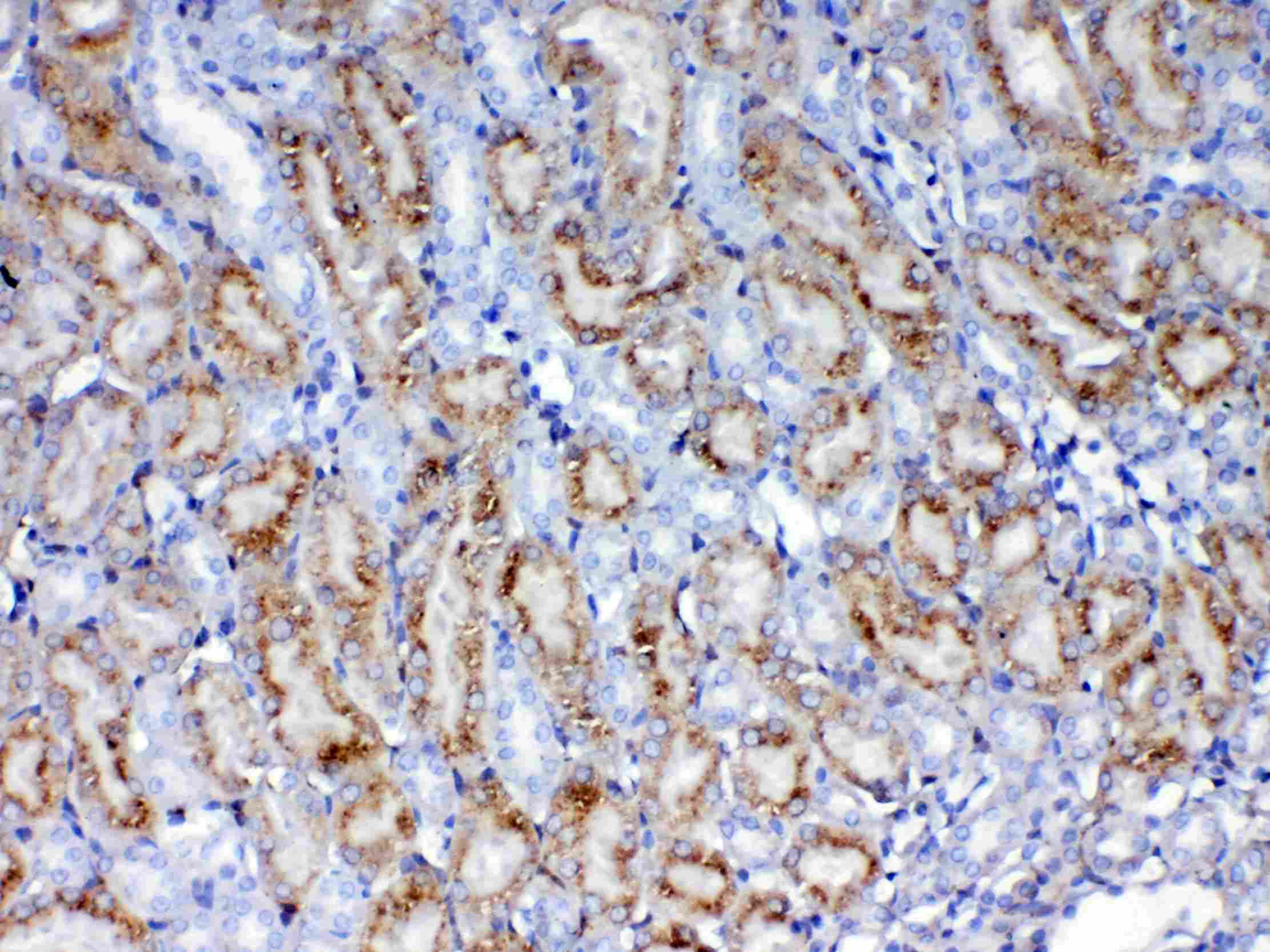 LGALS1 / Galectin 1 Antibody