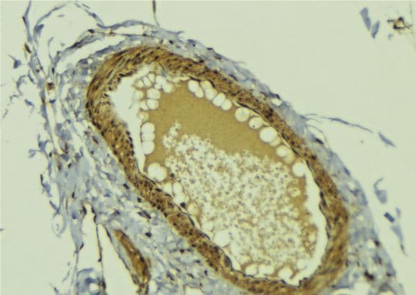 PINX1 Antibody