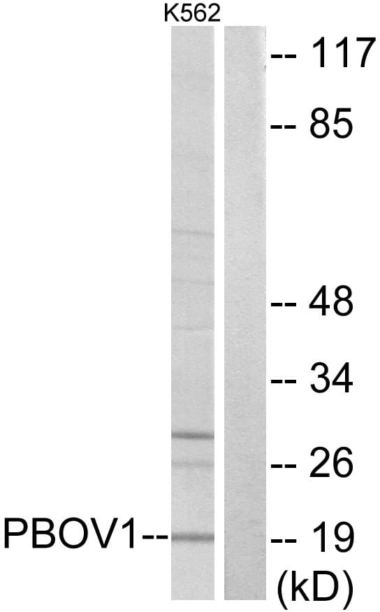 Polyclonal Rabbit anti-Human PBOV1 Antibody (aa31-80, WB)