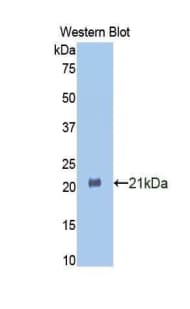 HSPBP1 Antibody (aa209-354)
