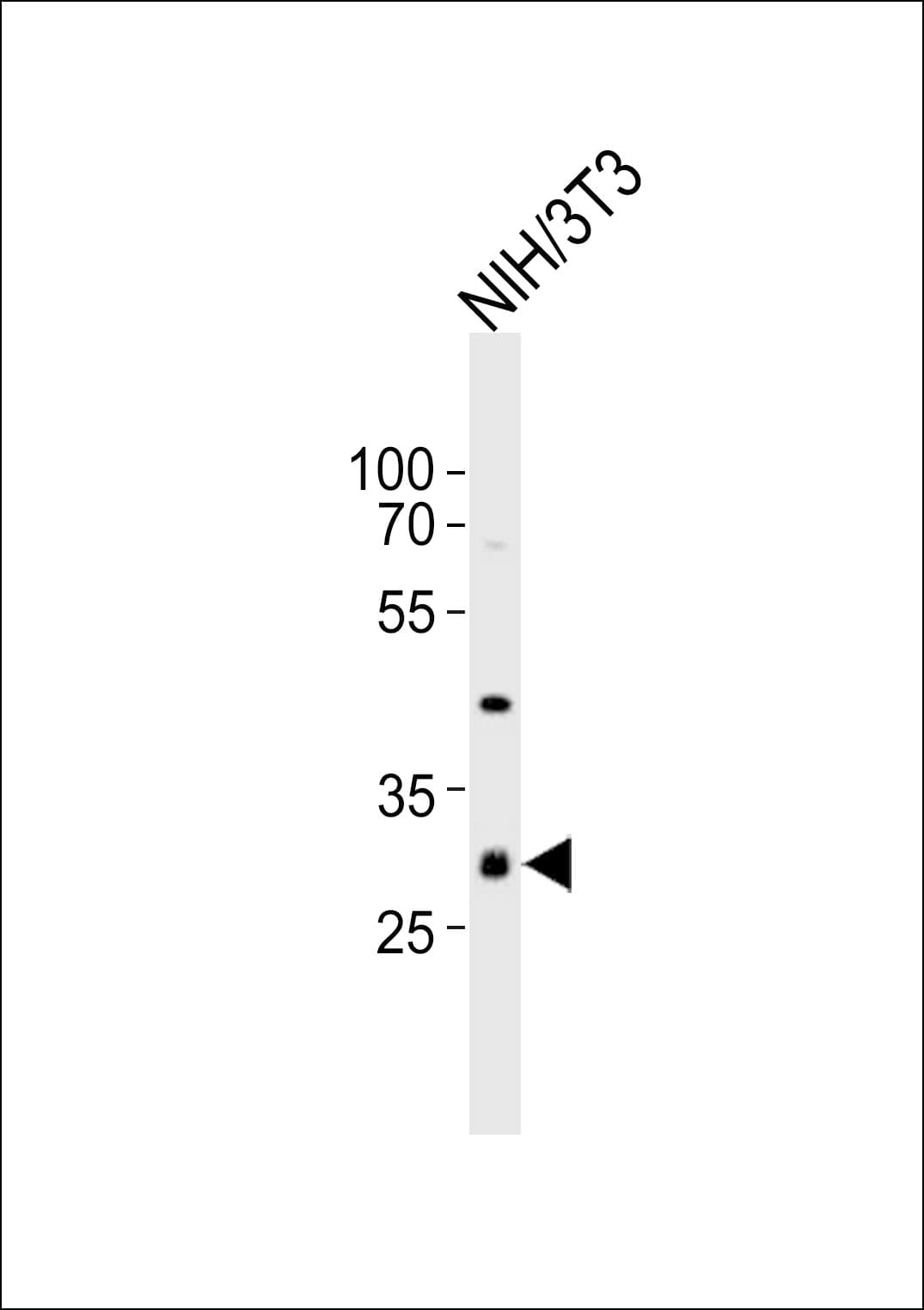 CDK5 Antibody (aa225-260)