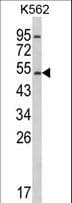Polyclonal Rabbit anti-Human CYP2E1 Antibody (aa402-429, IHC, WB)