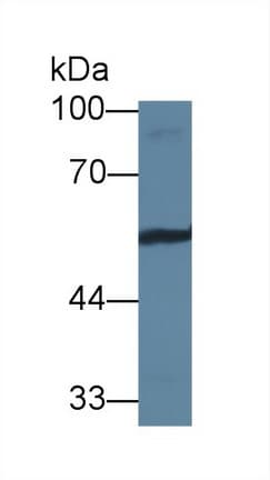 VTN / Vitronectin Antibody (aa19-111)