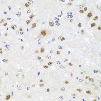 Polyclonal Rabbit anti-Human CETN3 Antibody (IHC, WB)
