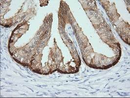 CRYM Antibody (clone OTI1B5)