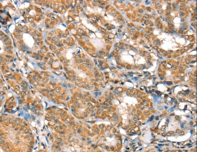 Polyclonal Rabbit anti-Human RBM5 / G15 Antibody (IHC, WB)