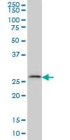 CA7 / Carbonic Anhydrase VII Antibody (clone 3B7)
