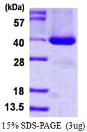 Human STAP1 / BRDG1 Protein (Recombinant His)