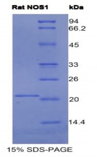 Rat NOS1 / nNOS Protein (Recombinant His)