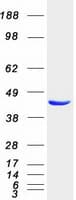 Human ACOT1 Protein (Recombinant Myc-DDK (Flag))