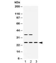 HPRT1 / HPRT Antibody