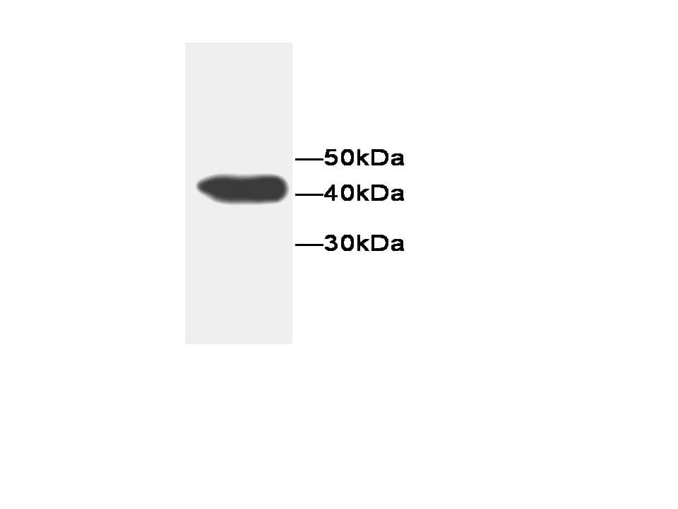 GHBP / BLVRB Antibody