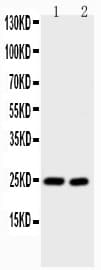 IL6 / Interleukin 6 Antibody (aa25-211)