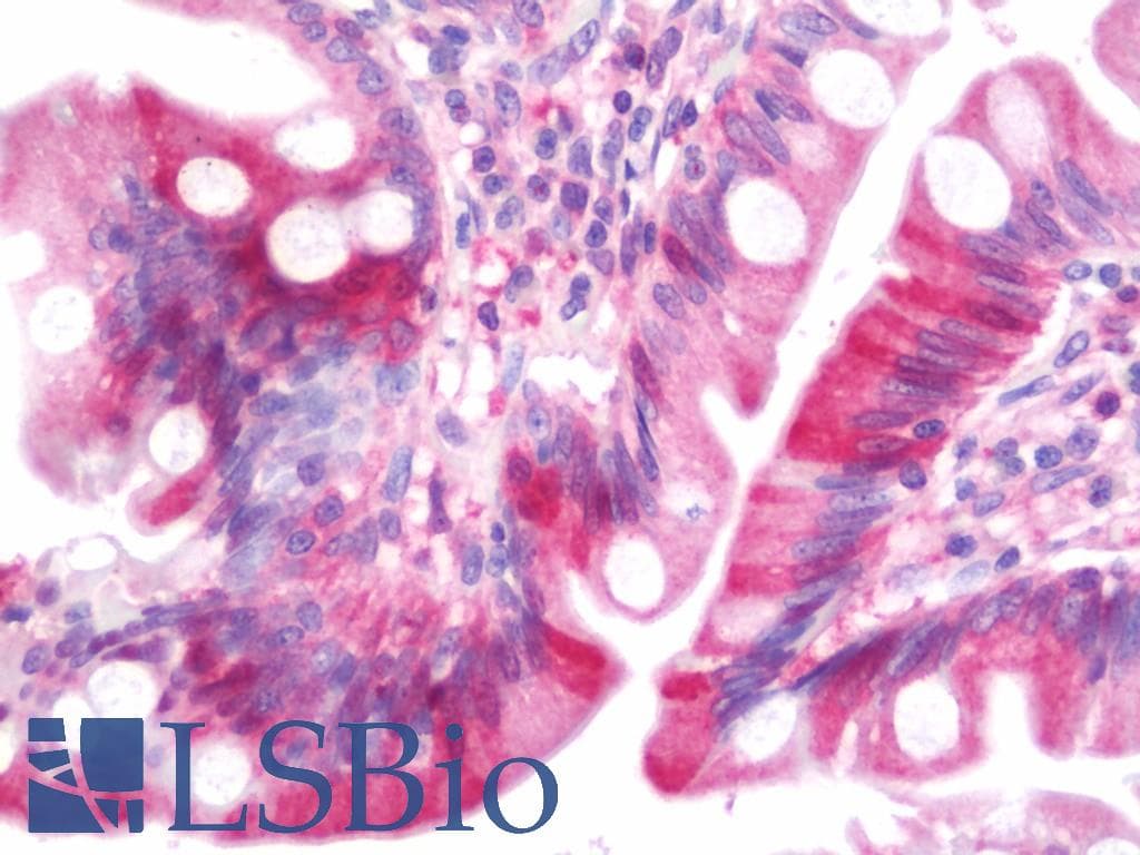 IHC-plus™ GLO1 / Glyoxalase I Antibody (aa1-184)