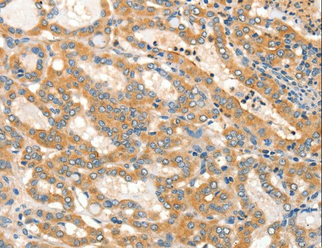 Polyclonal Rabbit anti-Human ADCY3 / Adenylate Cyclase 3 Antibody (IHC)