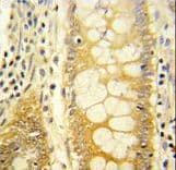 LGALS2 / Galectin 2 Antibody (aa85-111)
