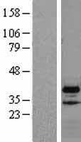 VPS37B Protein (Over-Expression Lysate Myc-DDK (Flag))