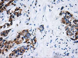 HSD17B10 / HADH2 Antibody (clone OTI5E2)