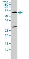 IHC-plus™ WDR20 Antibody (clone 2A6)