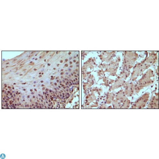 RB1 / Retinoblastoma / RB Antibody