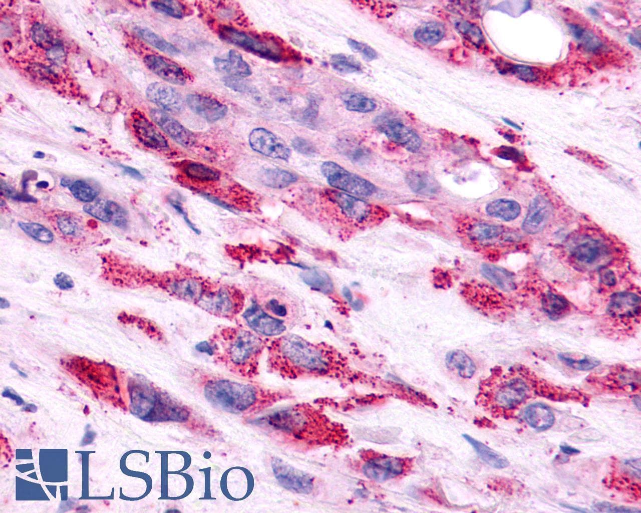 PathPlus™ AVPR2 / V2R Antibody (C-Terminus)