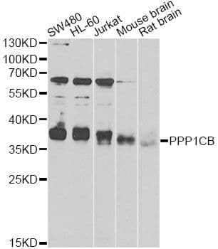 Polyclonal Rabbit anti-Human PPP1CB Antibody (WB)