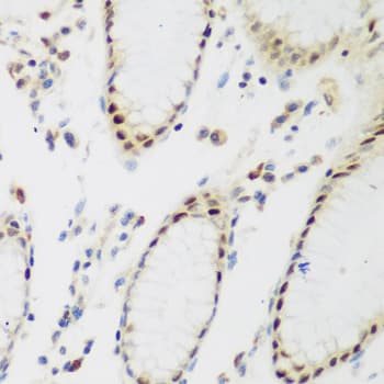 Polyclonal Rabbit anti-Human PPAN Antibody (IHC, IF, WB)