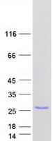 Human TRAPPC3L / BET3L Protein (Recombinant Myc-DDK (Flag))