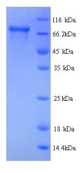 Human HSD17B4 Protein (Recombinant His)