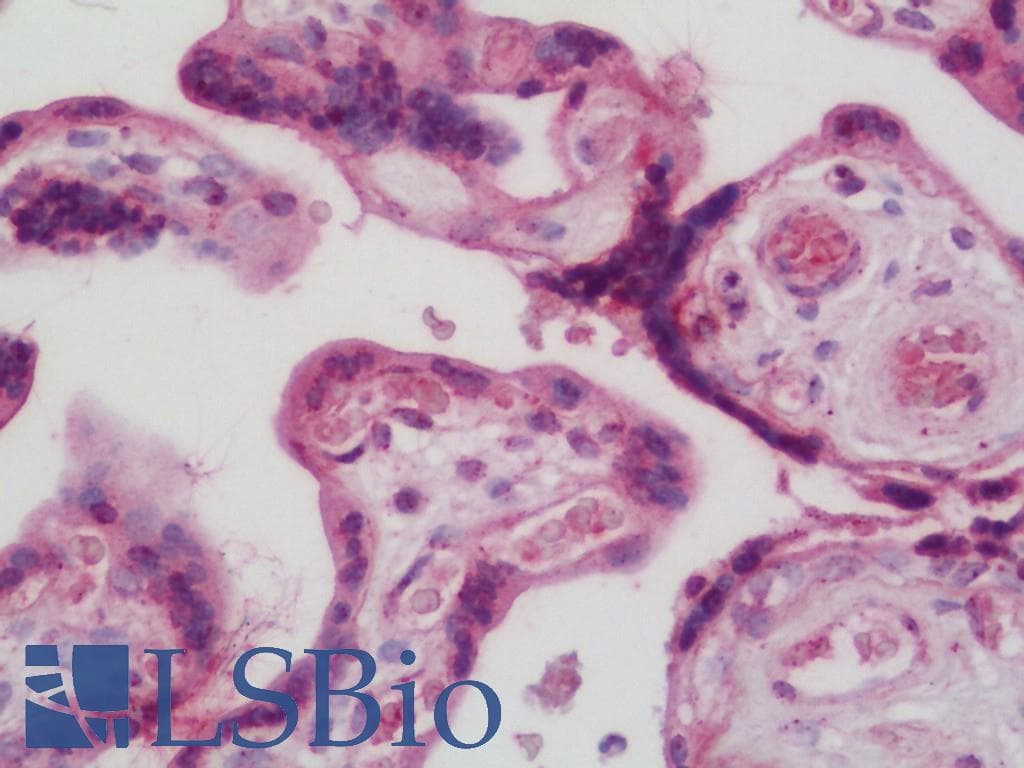 IHC-plus™ ITGAV/Integrin Alpha V/CD51 Antibody (aa755-804)
