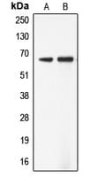 ADCK5 Antibody (Internal)
