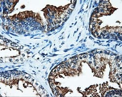 Monoclonal Mouse anti-Human SATB1 Antibody (clone OTI11E8, IHC, IF, WB)