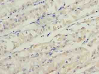 TMEM31 Antibody